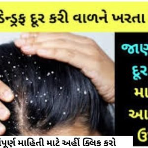 If you have dandruff in your head, use this remedy.