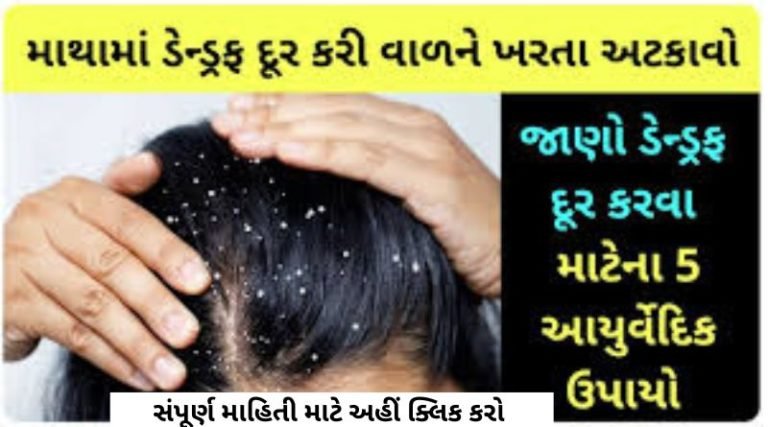 If you have dandruff in your head, use this remedy.